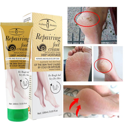 3x Foot Cream Snail Mucus Extract Anti-chafing Remove Dead Skin Moisturizing Anti-crack Whitening Smooth Skin Foot Skincare