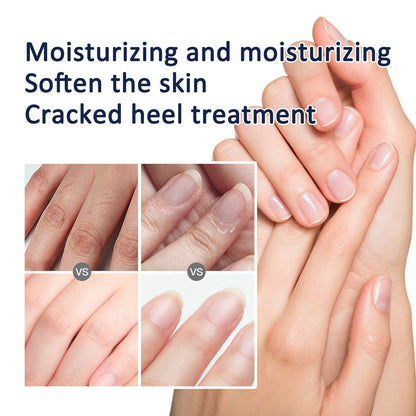 Anti-Drying Crack Foot Hand Cream Heel Cracked Repair Hand Feet Mask Moisturizing Whitening Dead Skin Removal Skin Care 30g