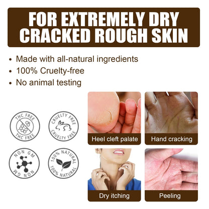 Herbal Anti Cracked Heel Treatment Cream Anti-Drying Removal Callus Dead Skin Balm Hand Foot Mositurizing Repair Skin Care Mask