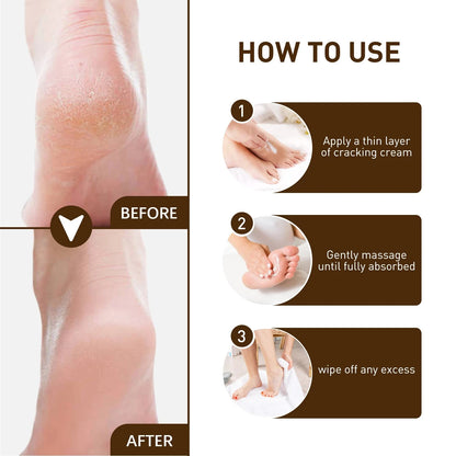 Herbal Anti Cracked Heel Treatment Cream Anti-Drying Removal Callus Dead Skin Balm Hand Foot Mositurizing Repair Skin Care Mask