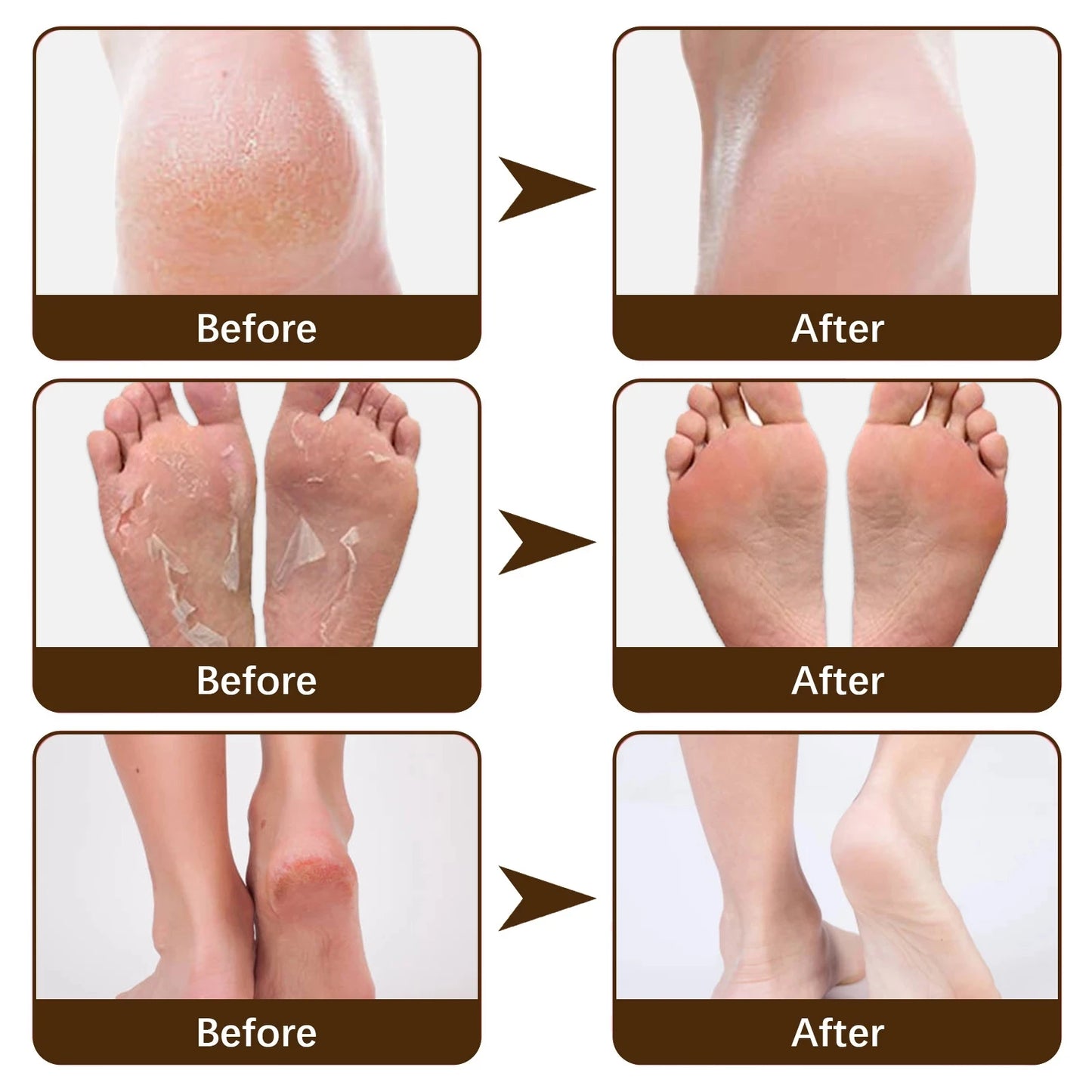 Herbal Anti Cracked Heel Treatment Cream Anti-Drying Removal Callus Dead Skin Balm Hand Foot Mositurizing Repair Skin Care Mask