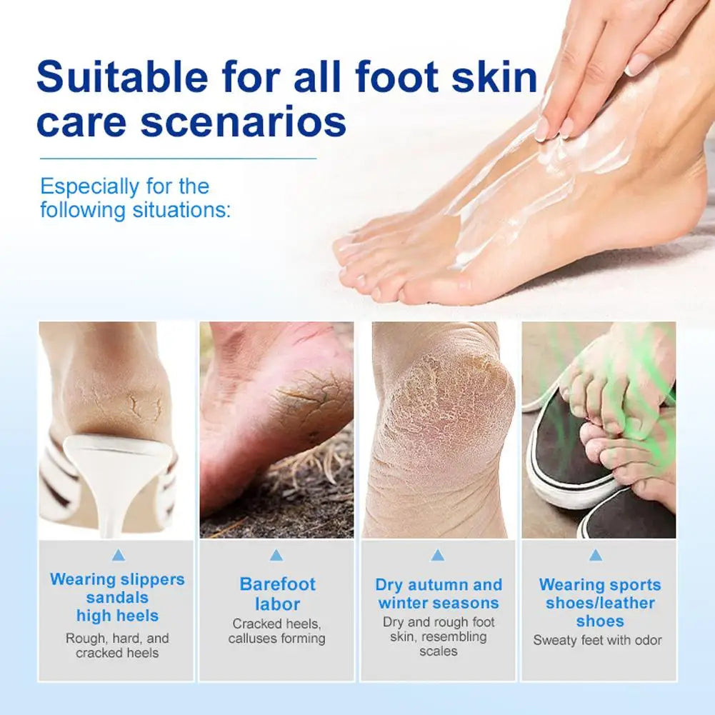 Urea Exfoliator Foot Cream Winter Dead Skin Remover Heel Crack Repair Cream Treatment Moisturizing Hand Feet Skincare Foot Mask